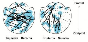 Representación en dos dimensiones del casco MEG. / Foto: UPM.